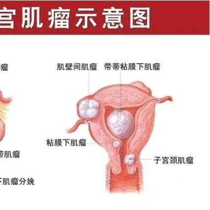 北京海扶刀技术哪家医院强？全面解析及应用指南